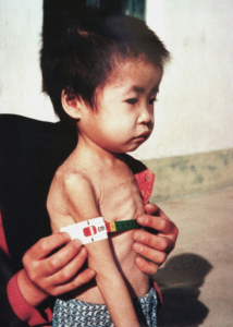 Nordkorea droht eine Hungersnot Eine Verkettung von Katastrophen und Planungsfehlern führt zur Ernährungslage von Kindern.